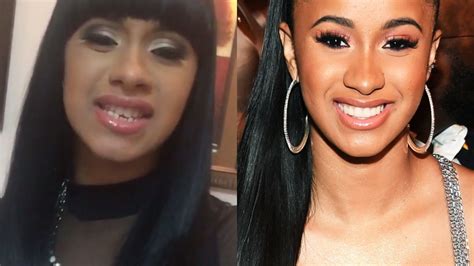 5 Celebrities with Veneers Who are Open About Their Experience