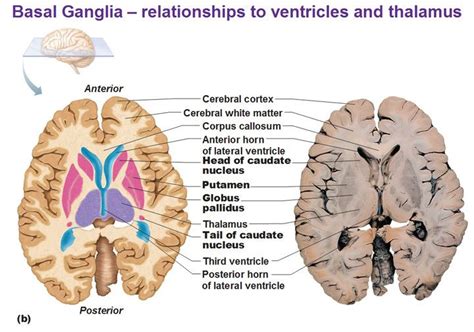 corpus striatum - Google Search Brain Anatomy, Medical Anatomy, Anatomy ...