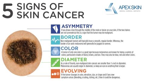 Skin Cancer – Apex Dermatology & Skin Surgery Center – Cleveland, OH ...