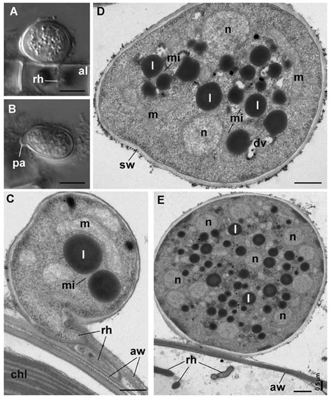 Sporangium structure of Sanchytrium tribonematis. A and B -DIC images ...