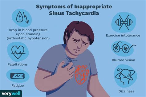 Inappropriate Sinus Tachycardia Causes and Treatment