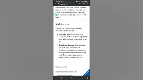 Chondrosarcoma symptoms, causes risk factors and treatment - YouTube