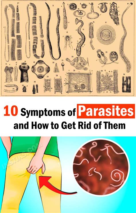 10 Symptoms of Parasites and How to Get Rid of Them | Parasites ...