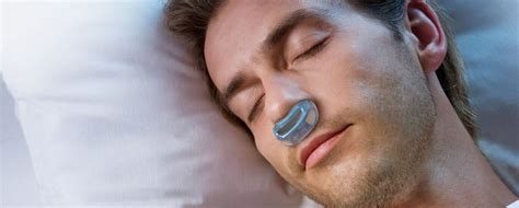 Global Sleep Apnea Implants Industry Propels at 13.8% CAGR, Poised to ...