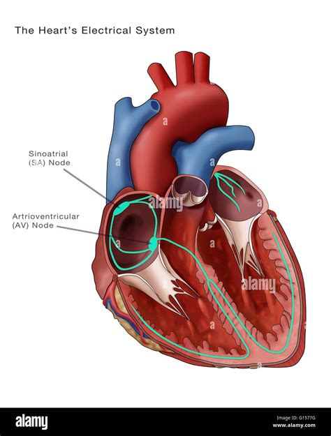 Atrioventricular Node