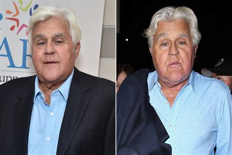 Jay Leno Teases That His 'Brand New Face' Is 'Better Than What Was ...