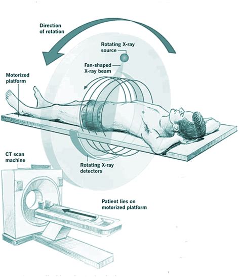 CECT Abdomen Cost, Procedure, Precautions, Purpose • BookmeriLab