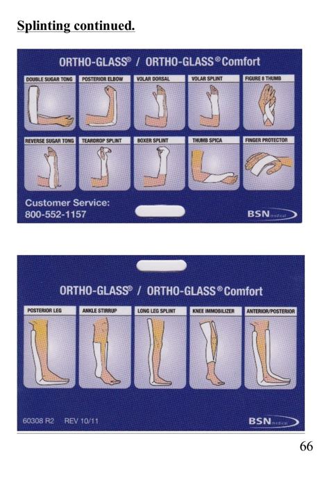 Ortho Glass Splints Chart