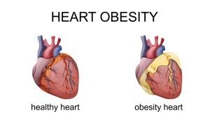 Heart Disease Caused By Obesity Calculator - PELAJARAN