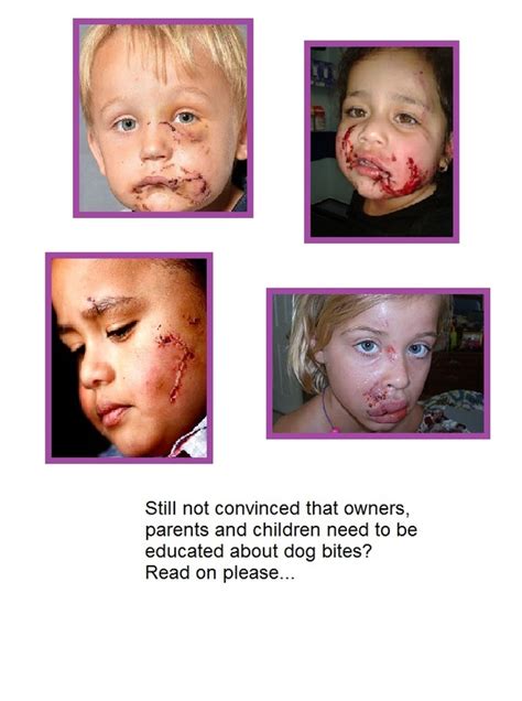 Dog Bites/Children and Dog Safety - SECOND CHANCE DOG RESCUE