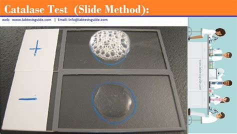 Catalase Test : Principle, Procedure, Results And More | Lab Tests Guide