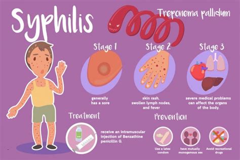 Syphilis - Causes, Treatment and More - Solution Parmacy