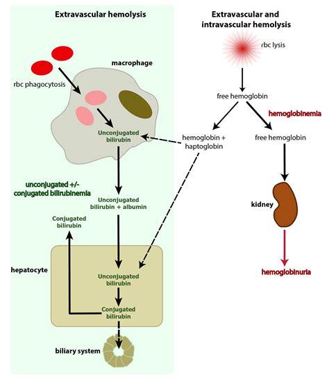 Bilirubin and hemolytic anemia | eClinpath