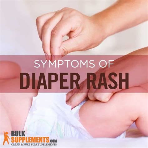 How To Know If It's Diaper Rash at James Smith blog