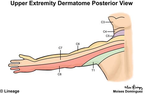 Dermatomes Neurology Medbullets Step 1 - Dermatomes Chart and Map