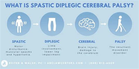 What Is Spastic Diplegia? - ABC Law Centers