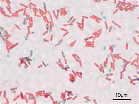 Specialized External Structures of Prokaryotes | Boundless Microbiology