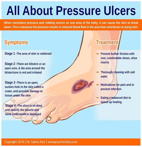 All About Pressure Ulcers Infographic | Foot & Ankle Specialty Group