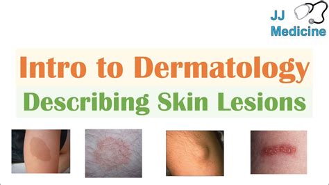 Introduction to Dermatology | The Basics | Describing Skin Lesions ...