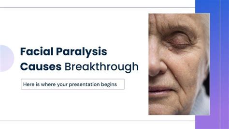 Facial Paralysis Causes Breakthrough Presentation