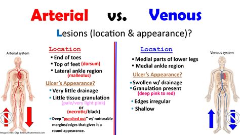 Arterial And Venous Ulcers