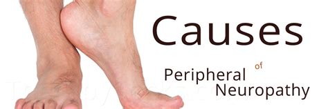 Common Causes of Peripheral Neuropathy in Your Feet | TherapySocks.com