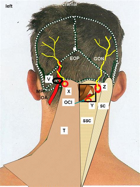 Occipital Nerve Block Anatomy