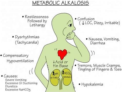 Metabolic alkalosis, definition, causes, symptoms, diagnosis, treatment ...