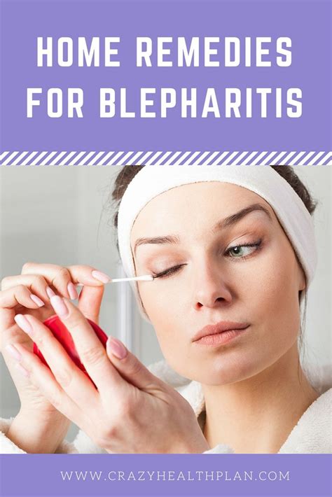 Natural Home Remedies For Blepharitis #homeremedies #homeremedy ...