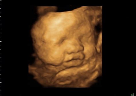 35 weeks in 3D Ultrasound | 35 weeks baby image in 3D ultras… | Flickr