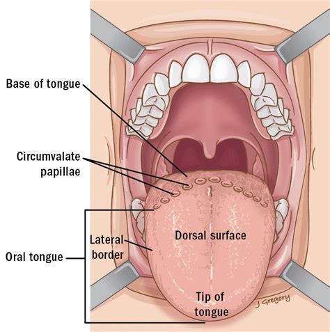 Tongue Cancer ‣ Anatomy ‣ THANC Guide