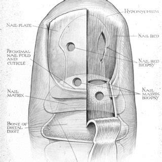 Lateral longitudinal excisional biopsy. A) Lateral longitudinal ...