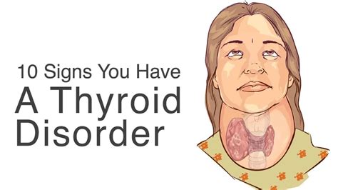 Thyroid Disease