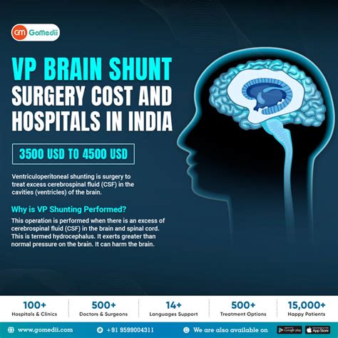 What Is The Brain VP Shunt Surgery Cost and Hospitals In India?-GoMedii