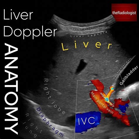 The Radiologist on Instagram: “⁣ ULTRASOUND DOPPLER⁣ ⁣ 👨🏽‍💻Here we are ...