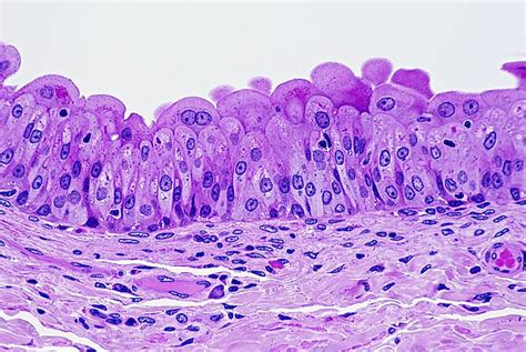 Transitional Epithelium of Human Bladder (Magnification x100). H & E ...