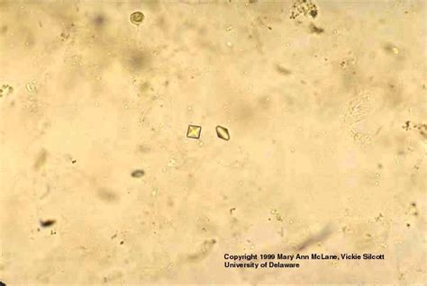 Calcium oxalate crystals | Medical Laboratories