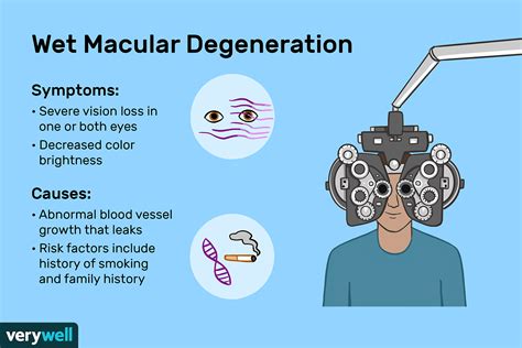 Wet Macular Degeneration: Symptoms, Causes, Diagnosis, Treatment, and ...