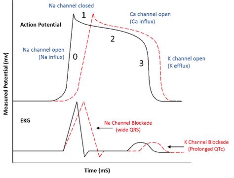 The QT Nomogram: Assessing Risk of Torsades de Pointes when the QT ...