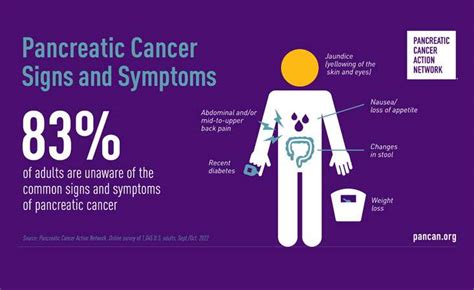 Most U.S. Adults Are Unaware Of The Signs And Symptoms Of Pancreatic ...