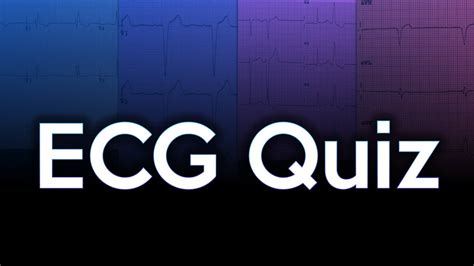 ECG Quiz Challenge - YouTube