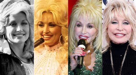 Dolly Parton Plastic Surgery Before & After Photos | Heavy.com