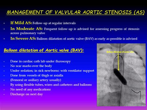 Management of Aortic Stenosis (AS) - Dr. Gaurav Agrawal