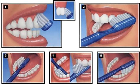 Proper Tooth Brushing and Flossing Techniques | Patient Education ...