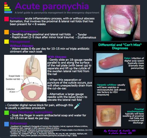 Paronychia — NUEM Blog