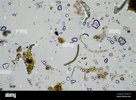 Hyphae Of Fungi Microscope