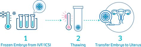 Frozen Embryo Transfer (FET) | Superior A.R.T.