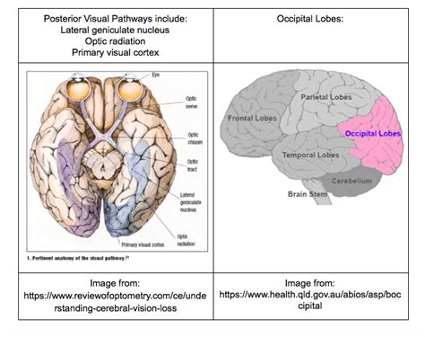 How can we adapt for Cortical Visual Impairments? — Therabeat, Inc.How ...