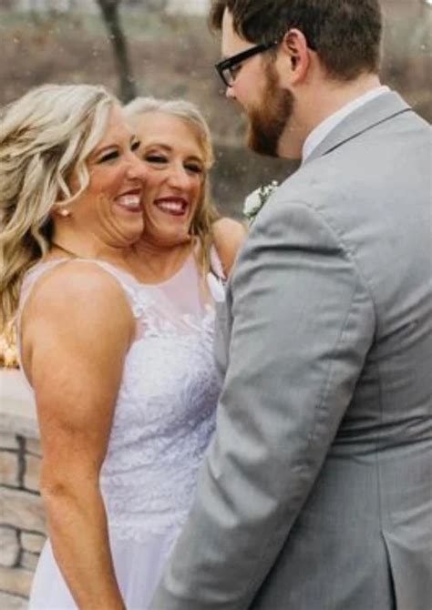 Un esposo para dos. Las hermanas siamesas comparten sus fotos de boda ...