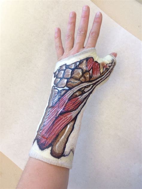 One of my friends had surgery on his hand and hand painted an exact ...